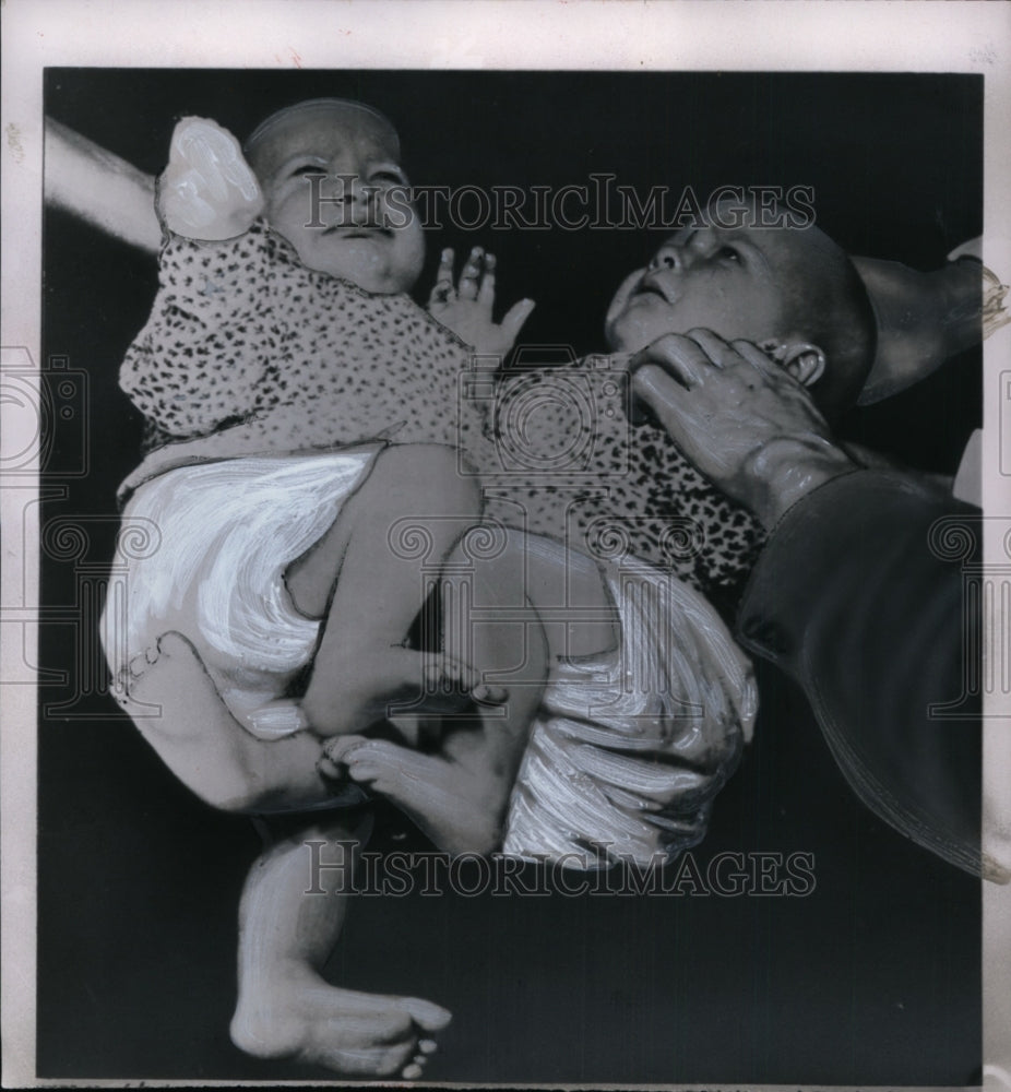 1954 Press Photo Siamese Twins Folkje & Tstitske de Vries of Netherlands