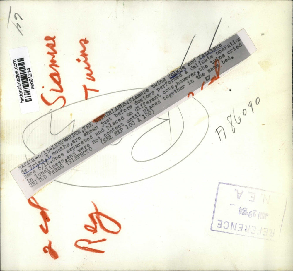 1954 Press Photo Siamese Twins Folkje & Tstitske de Vries of Netherlands