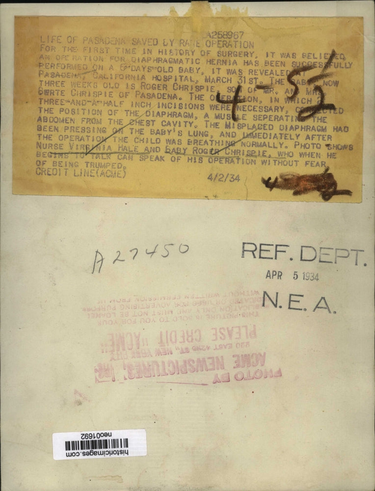 1934 Press Photo Roger Chrispie is First Baby to Have Diaphragm Hernia Operation