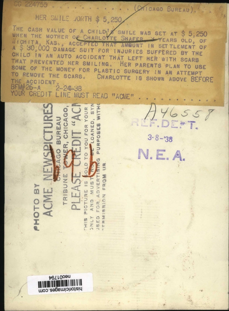 1938 Press Photo Charlotte Shafer, Little Girl Whose Smile Injured in Car Wreck