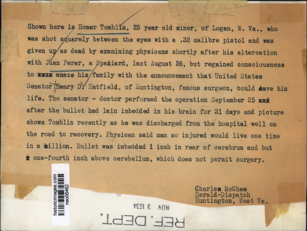 1934 Press Photo Homer Tomblin, Bullet Wound Healed with Henry Hatfield Surgery