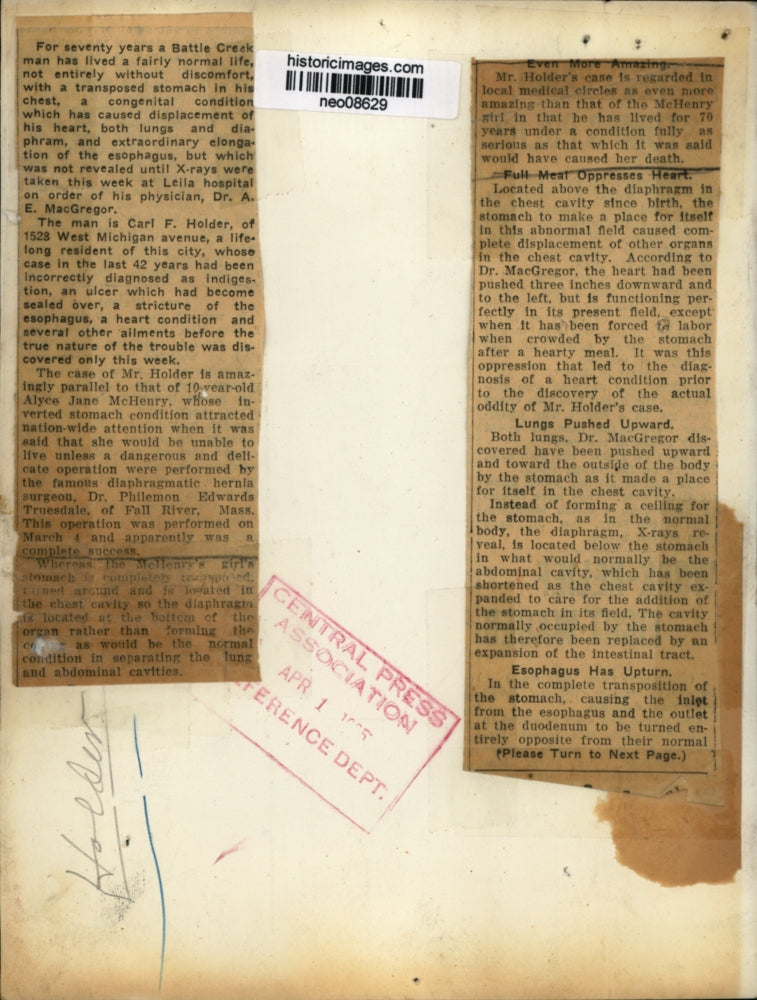 1935 Press Photo Carl. F. Holder of Battle Creek, Man with Many Ailments