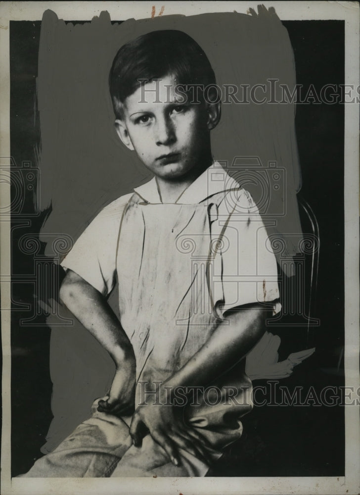 1934 Press Photo Benny Hendrick vixtim of myositis ossification progressiva