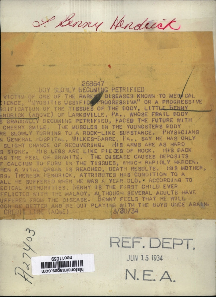 1934 Press Photo Benny Hendrick vixtim of myositis ossification progressiva