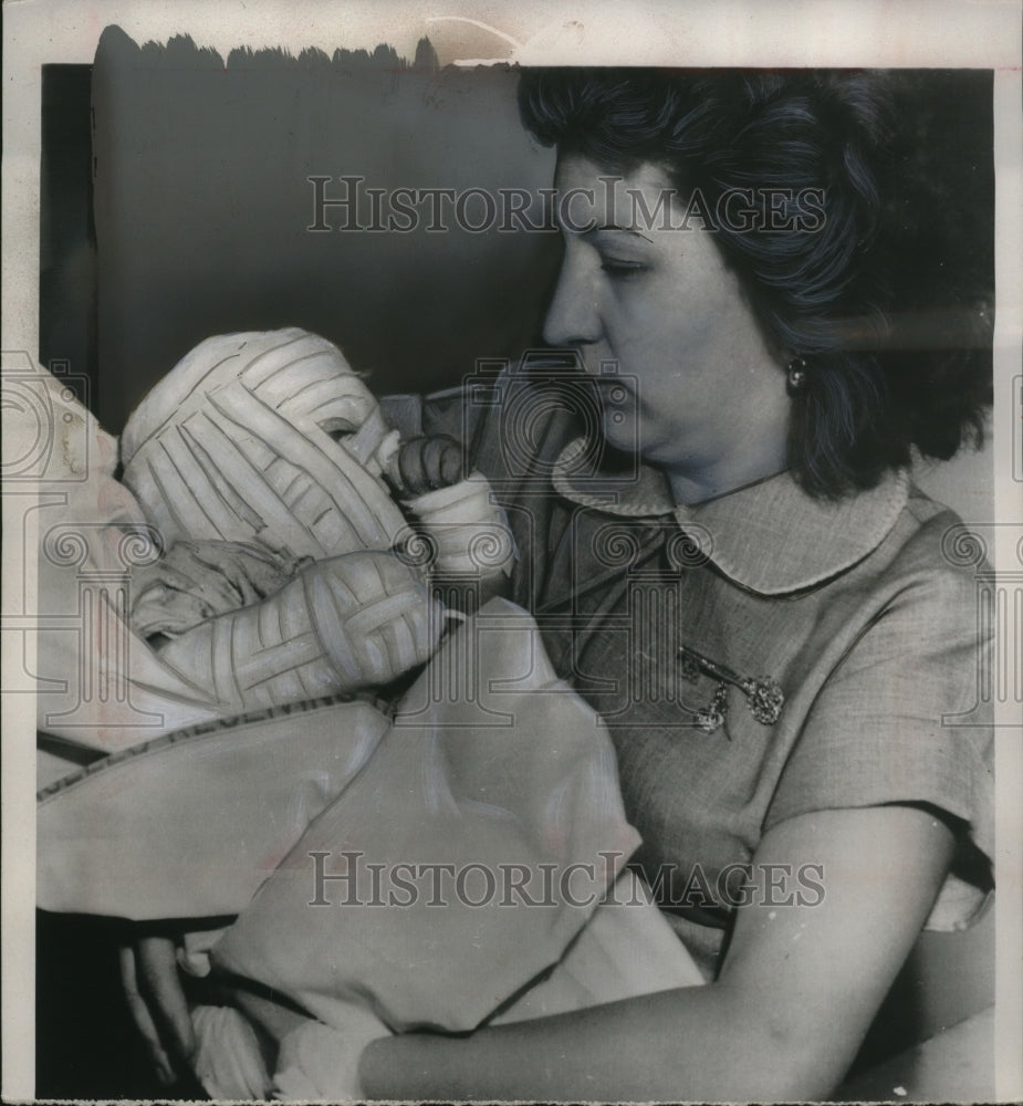 1954 Press Photo Mrs. Carleene Chavez Holds Her Burn-Injured Infant, Randy