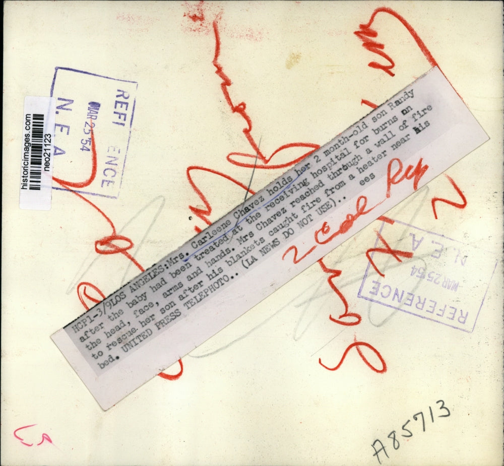 1954 Press Photo Mrs. Carleene Chavez Holds Her Burn-Injured Infant, Randy