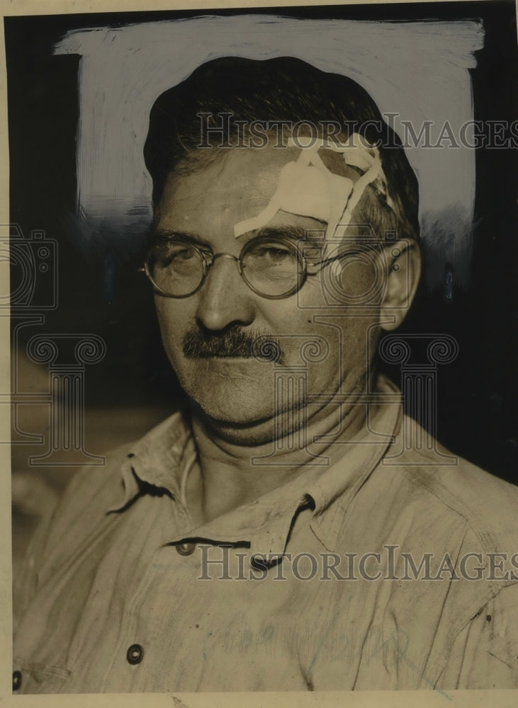 1922 Press Photo Milford Maxwell with a wound on his head - neo24643