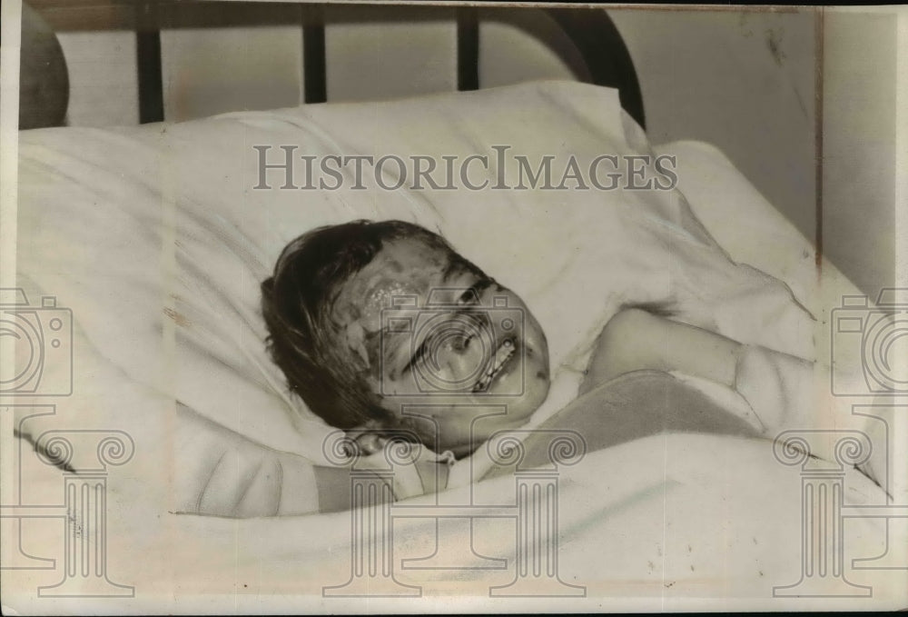 1947 Press Photo Donald Dunlap of St. Louis, Mother Threw Gasoline on Family