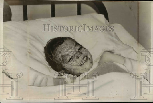 1947 Press Photo Donald Dunlap of St. Louis, Mother Threw Gasoline on Family