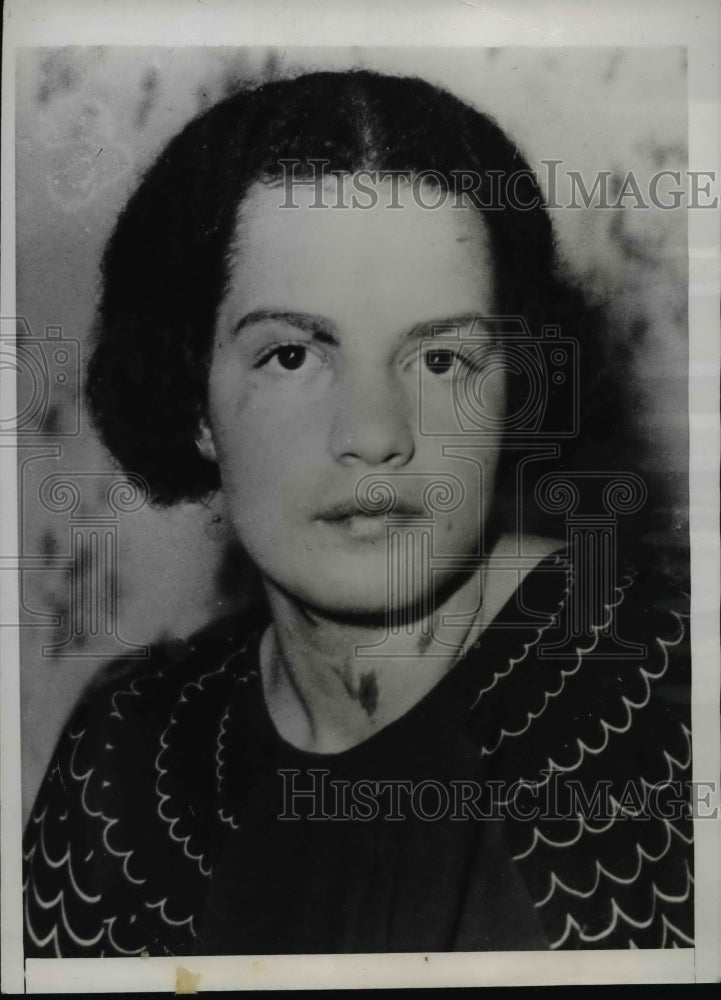 1935 Press Photo Lucille Le Cates, Philadelphia, Pennsylvania Assault Victim