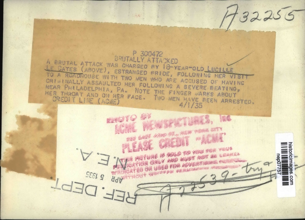 1935 Press Photo Lucille Le Cates, Philadelphia, Pennsylvania Assault Victim