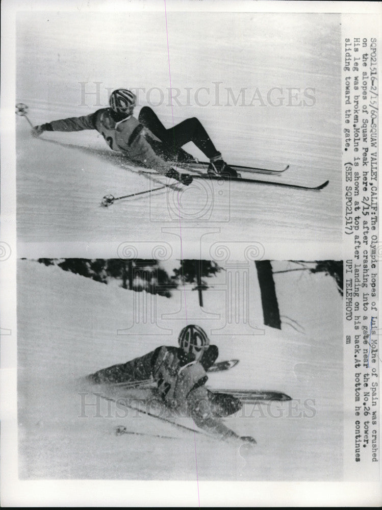 1960 Press Photo Luis Molne breaks a leg skiing at Squaw Valley CA - nes05991- Historic Images