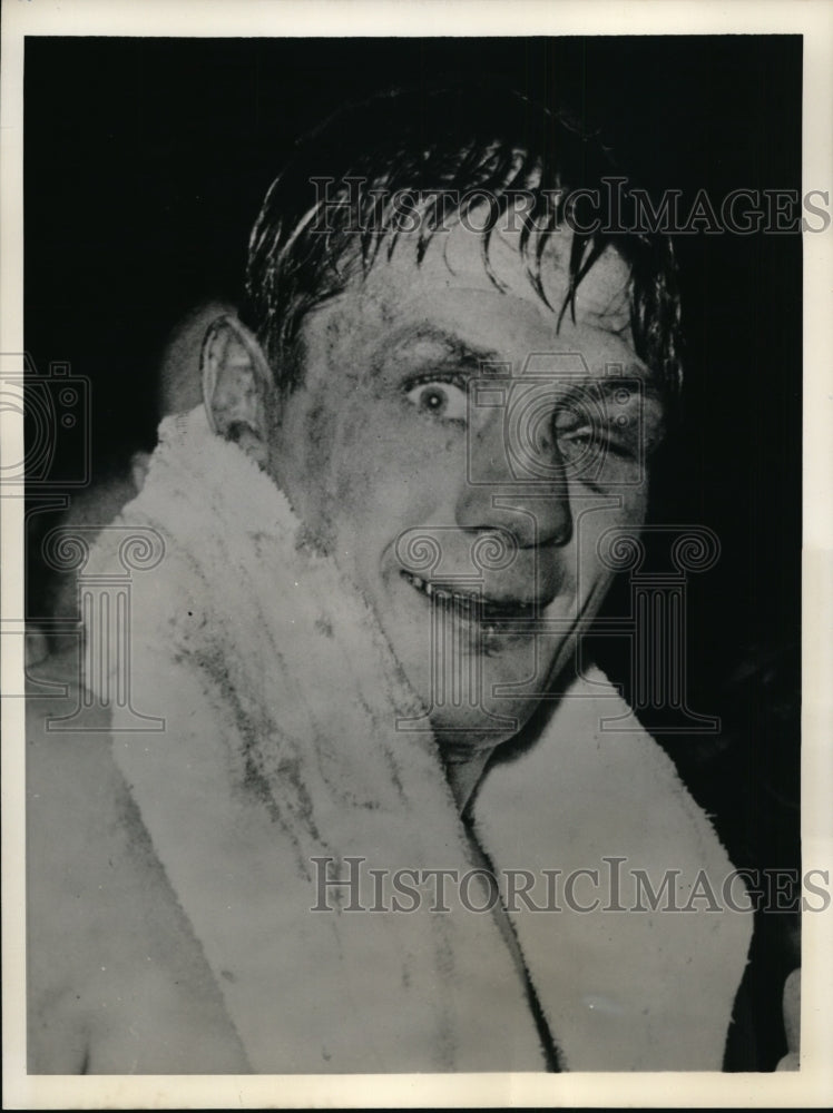 1955 Press Photo Ray Famechon after losing European featherweight title- Historic Images