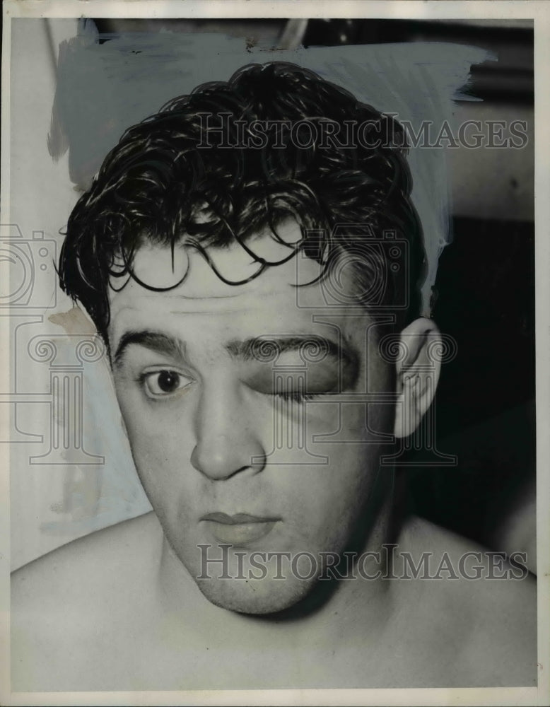 1940 Press Photo Boxer Al McCoy as he looked after a fight - net20025- Historic Images