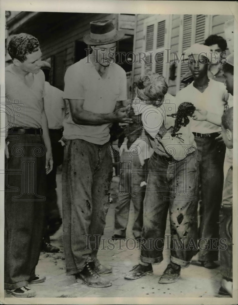 1938 Press Photo Arthur Piccla, casualty of clash between CIO and AFL teamsters.