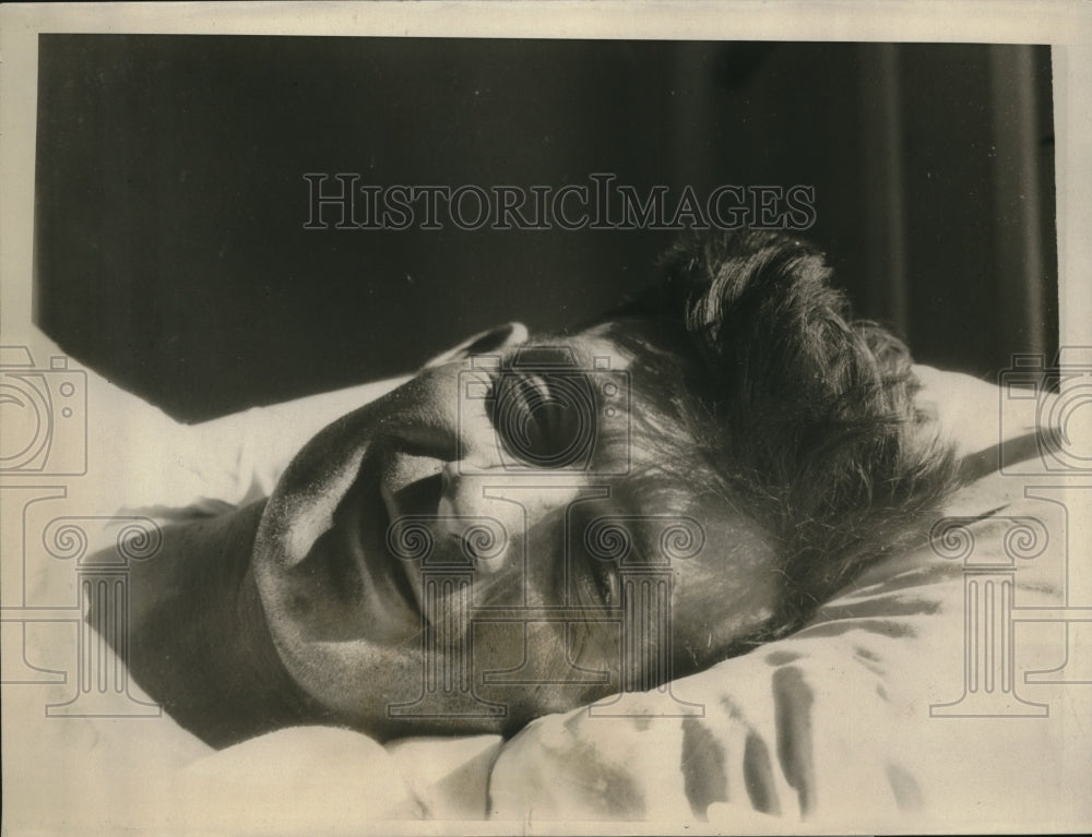 1926 Press Photo GJ Potter painter who fell from 10th floor in hospital