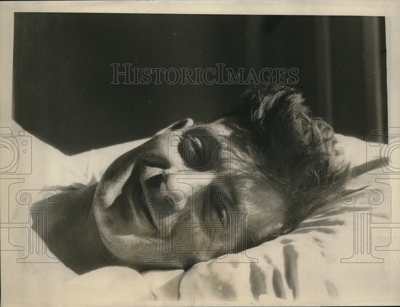 Load image into Gallery viewer, 1926 Press Photo GJ Potter painter who fell from 10th floor in hospital
