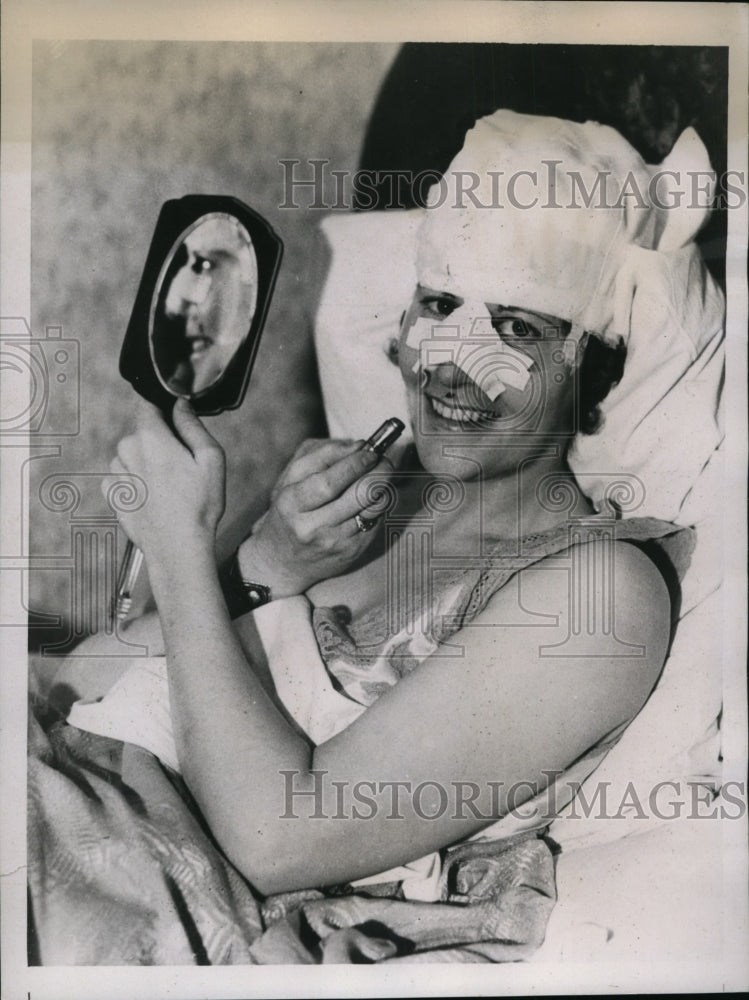 1936 Press Photo Stunt flyer Adoree Nevile breaks nose in fall from hotel bed
