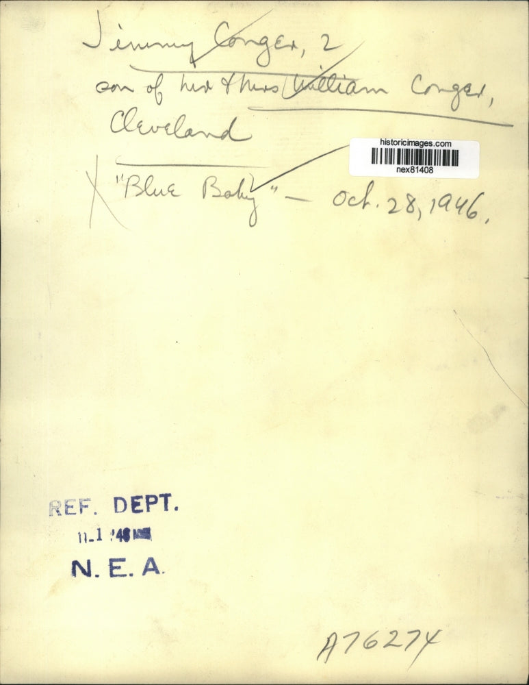 1948 Press Photo Toddler Jimmy Conger of Cleveland Has Heart Operation