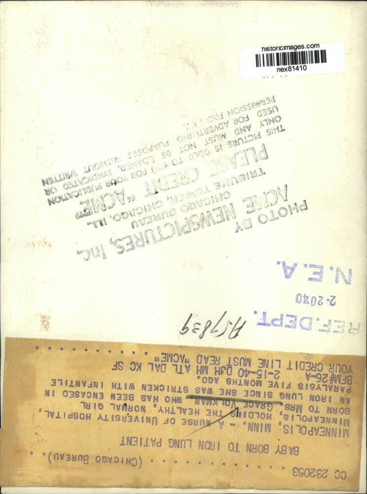 1940 Press Photo Polio Victim Mrs Grace Volkman Gives Birth to Baby Minneapolis