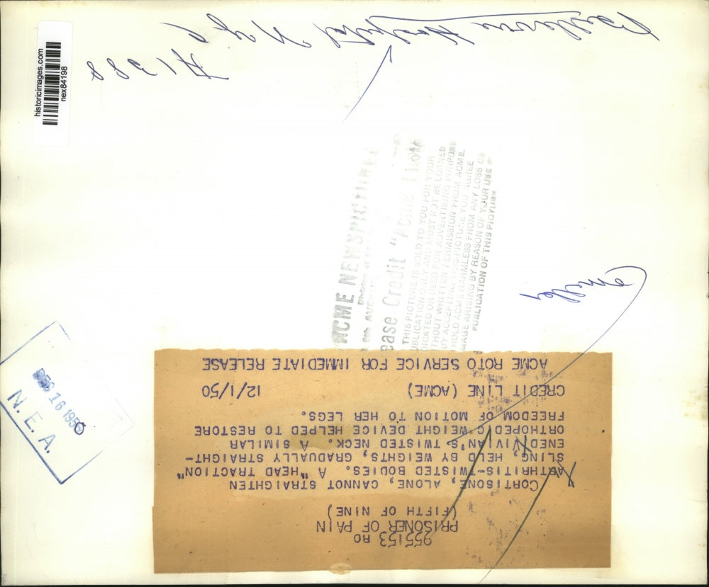 1950 Press Photo Patient Vivian treated for child arthritis by a nurse