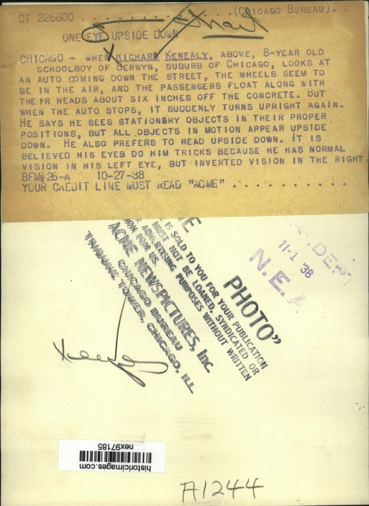 1938 Press Photo Richard Kenealy of Chicago Has Inverted Vision in Right Eye