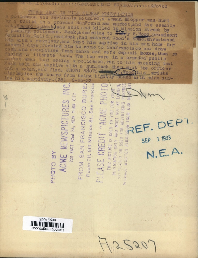 1953 Press Photo William F. Wood, Kidnapping Victim Displaying Wrist Scars