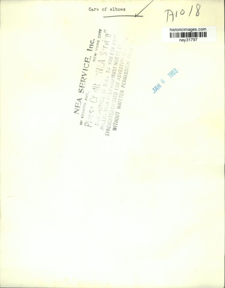 1951 Press Photo Unidentified Female Demonstrates Care of Elbows