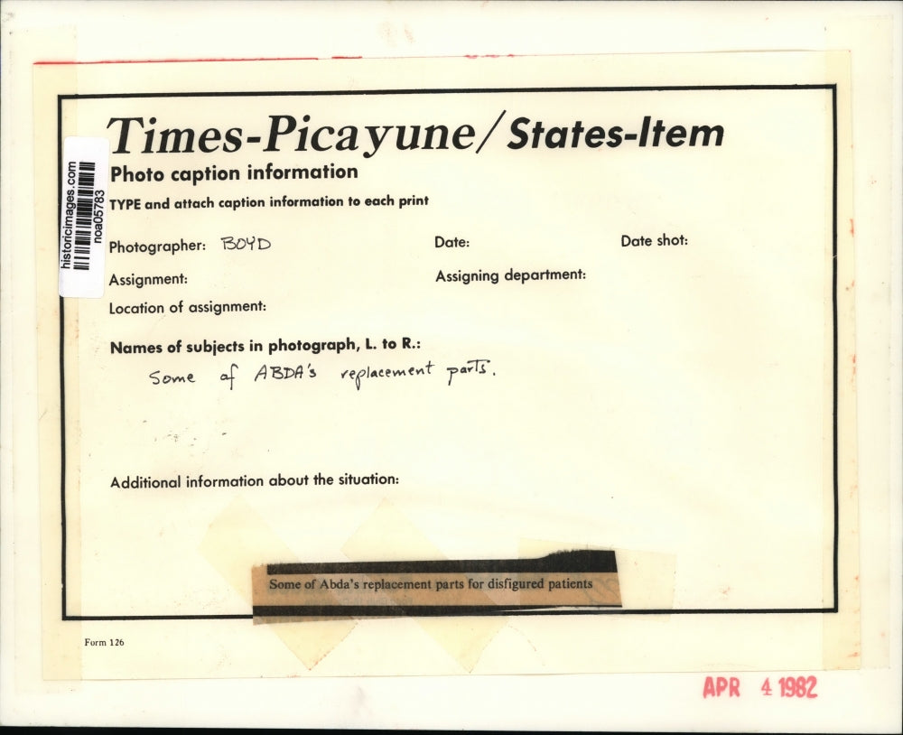 1982 Press Photo Some of Abda's replacement parts for disfigured persons.