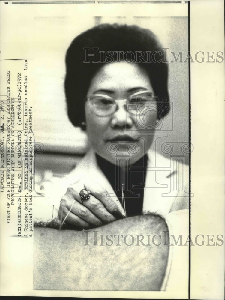 1972 Press Photo A Chinese doctor, trained in mainland China inserts needles.