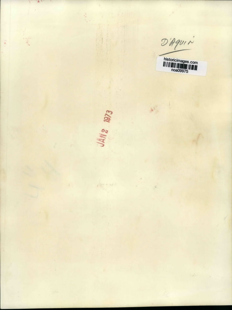 1972 Press Photo A Chinese doctor, trained in mainland China inserts needles.