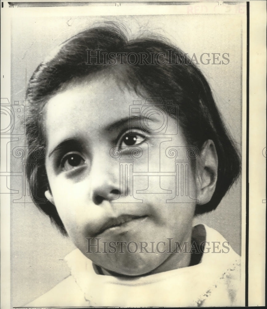 1970 Press Photo Elena Arroyo, Otomi Indian Girl Born Without Ears - noa18500