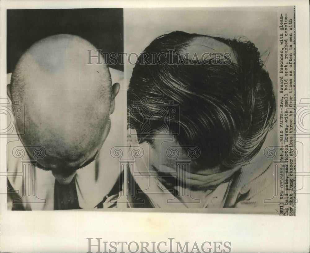 1964 Press Photo Doctors Howard Buechner, Morton Brown, Lung Cancer Researchers