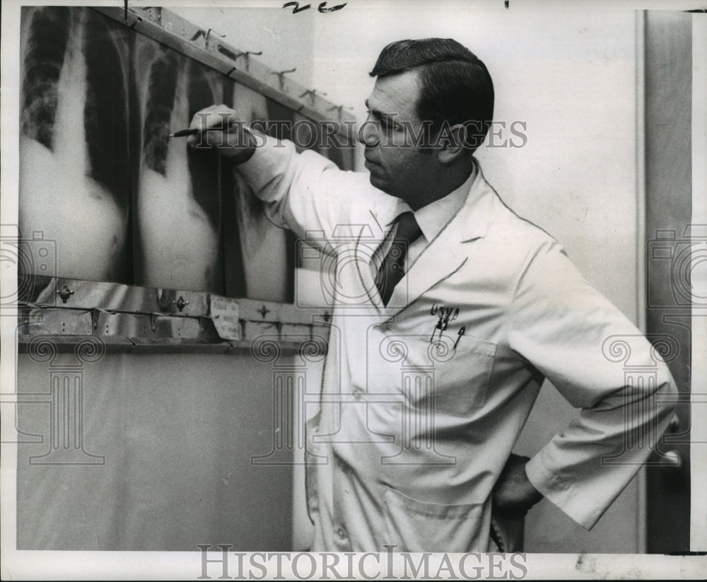 1969 Press Photo Dr. Morton Brown check x-rays at V.A. Hospital- Historic Images