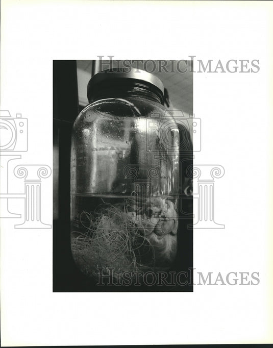 1993 Press Photo A jar containing a dog's heart with dozens of heartworms- Historic Images