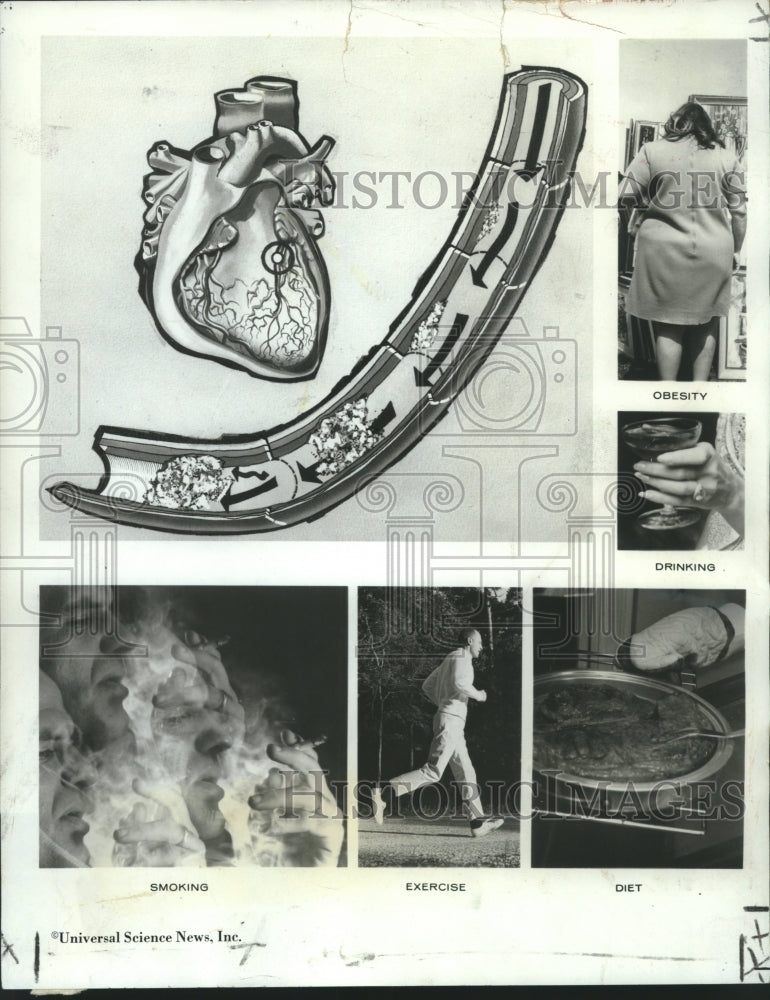 1971 Press Photo Health - Study of How to Die of a Heart Attack - nob33716