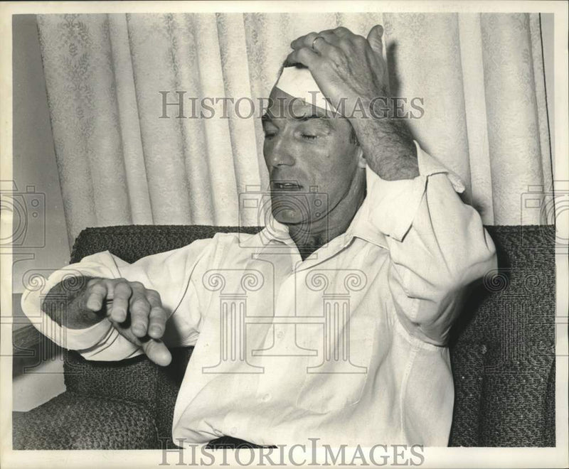 Load image into Gallery viewer, 1961 Press Photo Melvin Miller Jr. shows his injuries - nob85983
