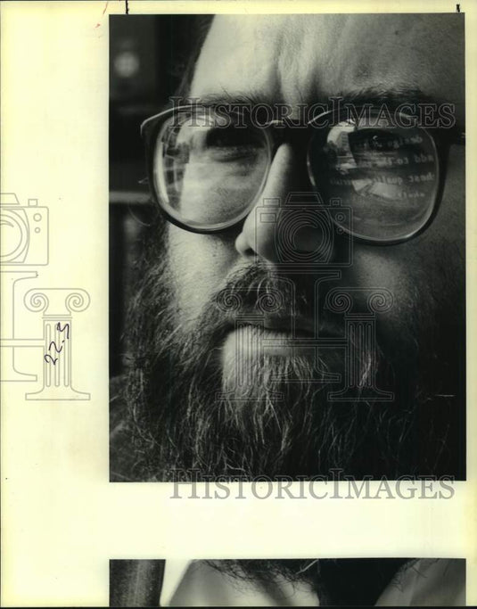 1990 Press Photo City Attorney Bruce Naccari has retinal disorder- Historic Images
