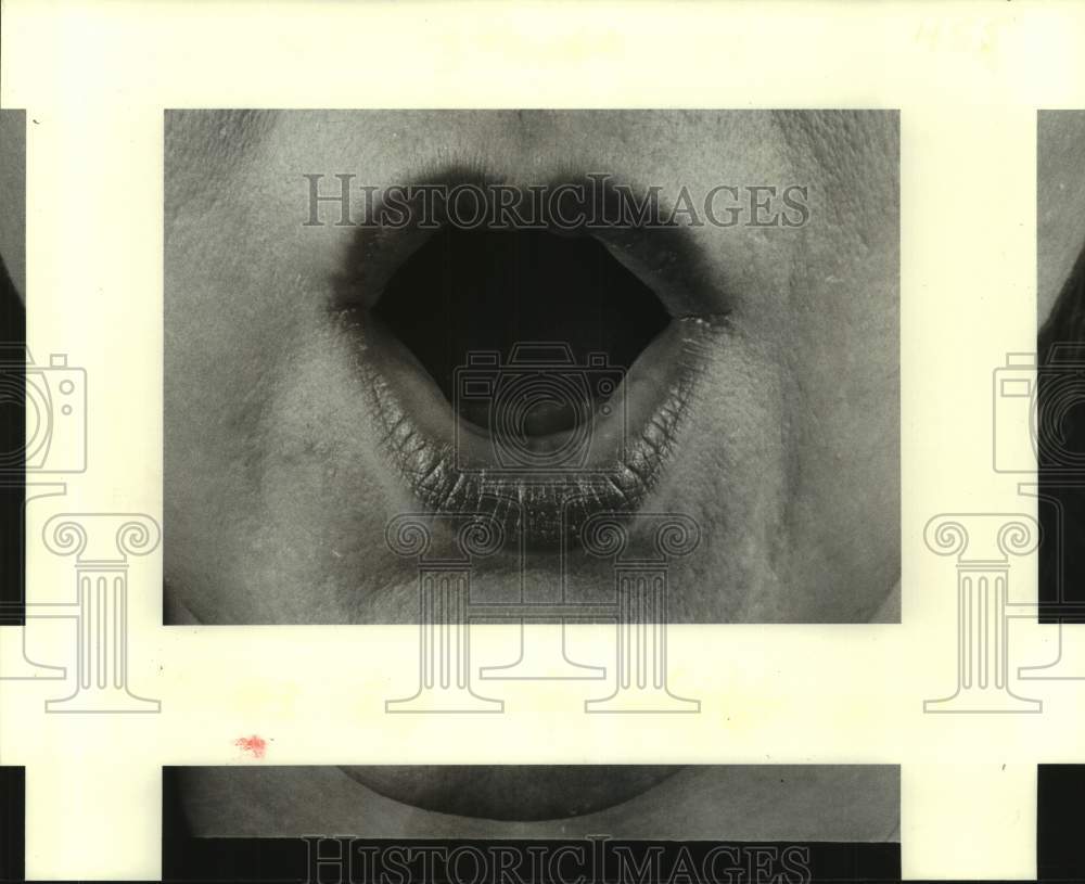 1982 Press Photo Close up view of lips- Historic Images