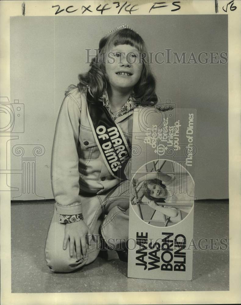 1974 Press Photo Jamie Gay Weaver, the 1975 March of Dimes poster child- Historic Images