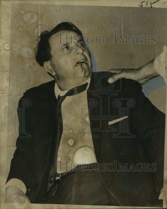 1966 Press Photo Giuseppe Corona, Charged with Aggravated Battery for Fight