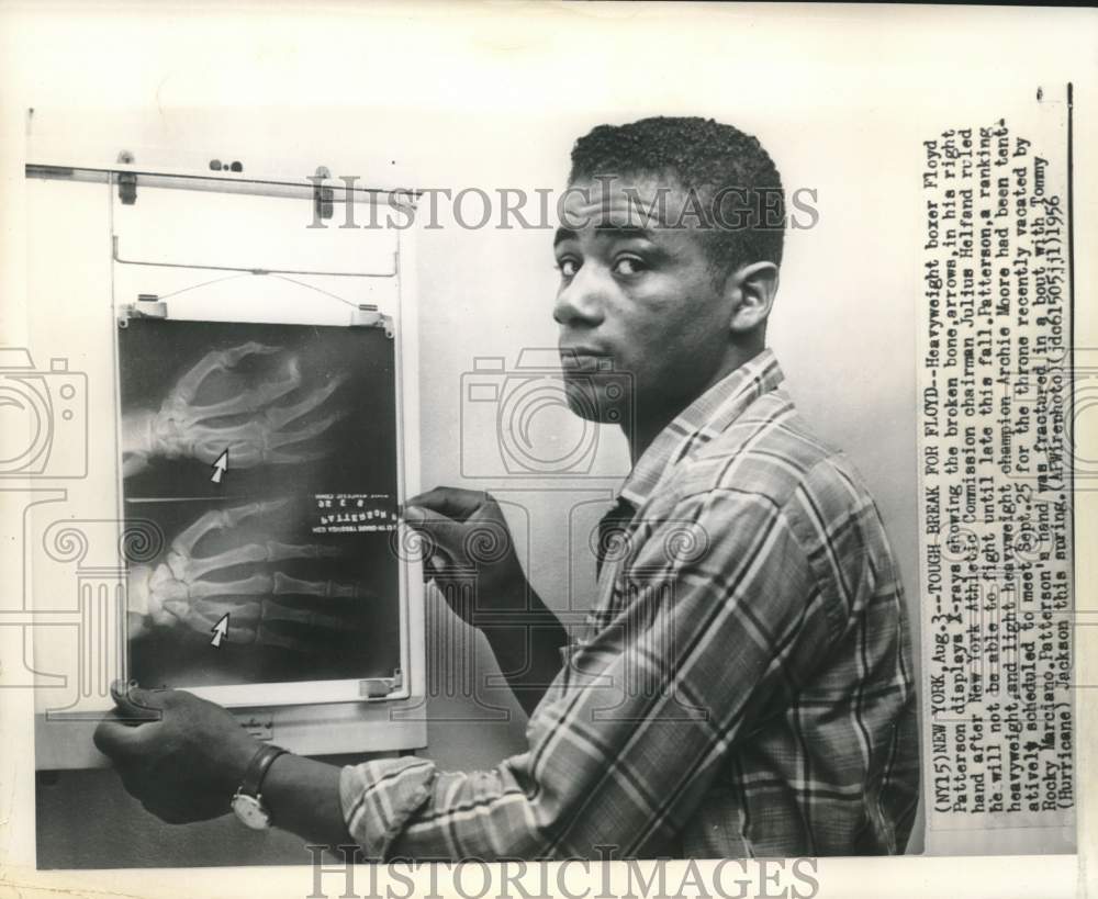 1956 Press Photo Boxing - Floyd Patterson with X-rays of Broken Bone in Hand- Historic Images