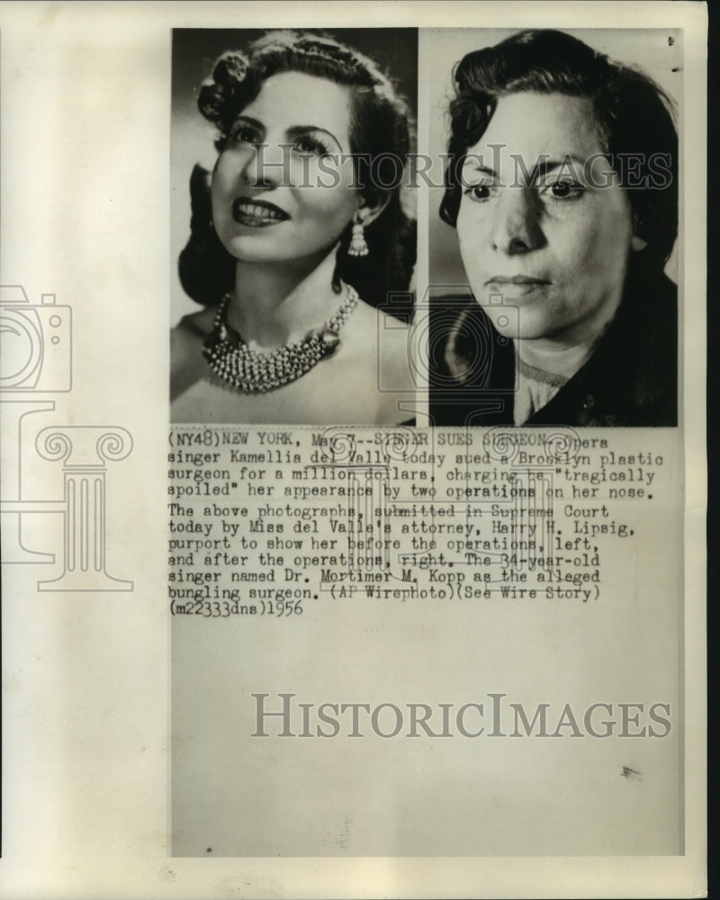 1956 Press Photo Opera singer Kamellia del Walle before and after Nose Surgery- Historic Images