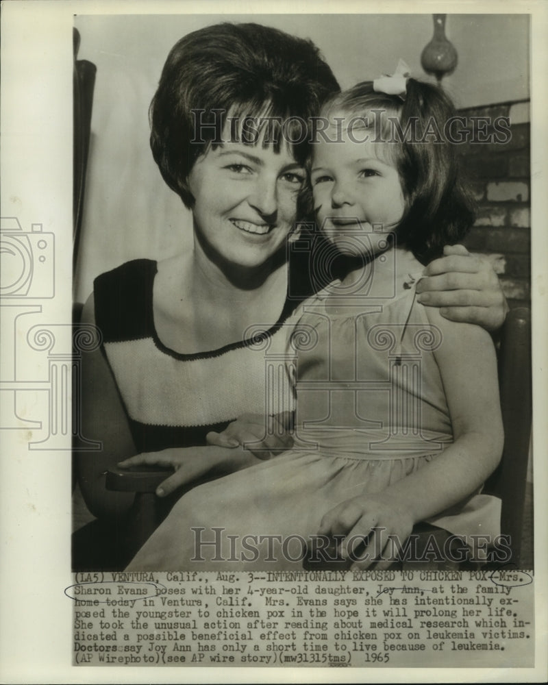 1965 Press Photo Sharon Evans exposed Joy Ann to chicken pox to save her life