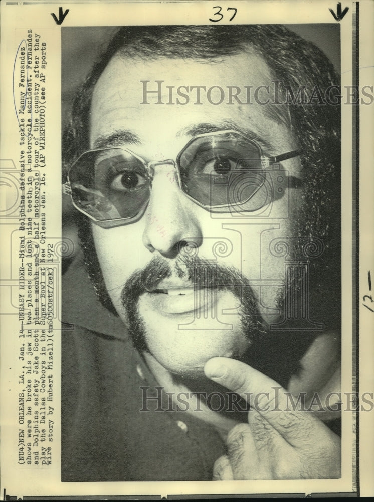 1972 Press Photo Miami Dolphins tackle, Manny Fernandez, shows broken jaw