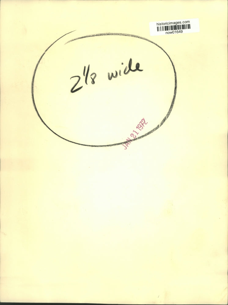 1972 Press Photo Miami Dolphins tackle, Manny Fernandez, shows broken jaw