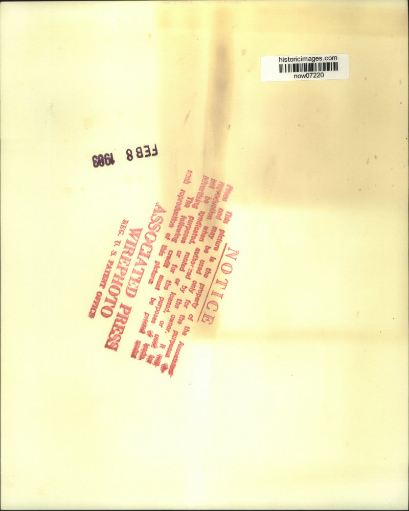 1963 Press Photo Patricia Kay Hashagen lost her suit against dentist, Dr. Bunch