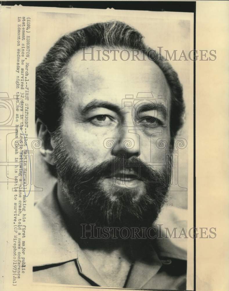 1973 Press Photo Pilot Martin Hartwell, survivor of Arctic plane crash in Canada