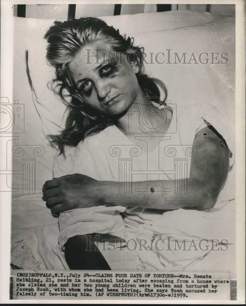 1959 Press Photo Mrs. Renate Helbing rests in hospital after beating in New York