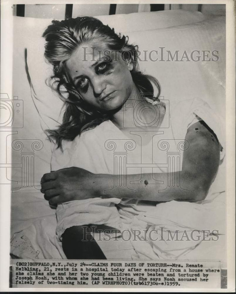 Load image into Gallery viewer, 1959 Press Photo Mrs. Renate Helbing rests in hospital after beating in New York
